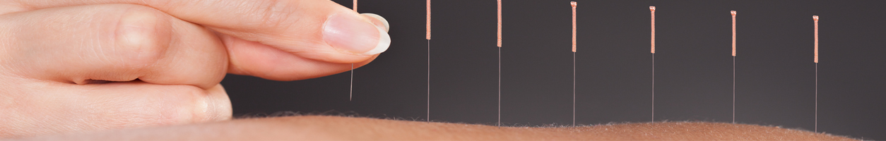 Acupuncture Blackburn